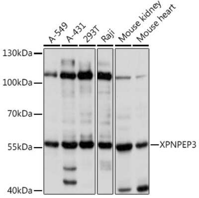 Western Blot: XPNPEP3 AntibodyAzide and BSA Free [NBP2-93838]